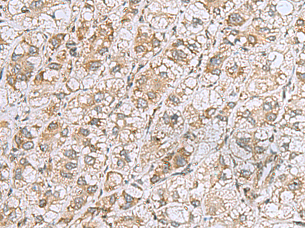 Anti-CCDC134 Rabbit Polyclonal Antibody