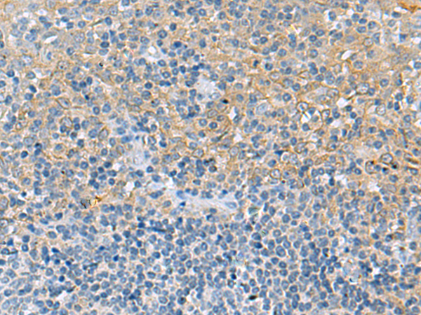 Anti-LRAT Rabbit Polyclonal Antibody