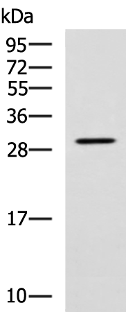 Anti-LRAT Rabbit Polyclonal Antibody
