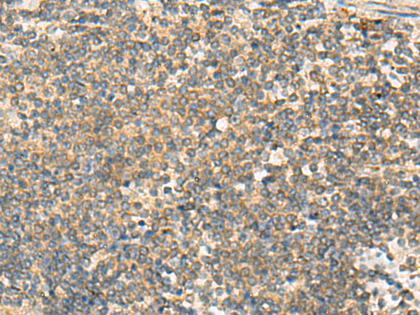 Anti-PAFAH1B3 Rabbit Polyclonal Antibody