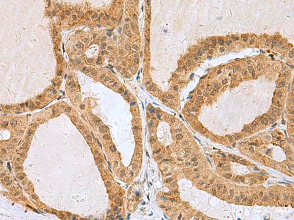 Anti-EXOSC4 Rabbit Polyclonal Antibody
