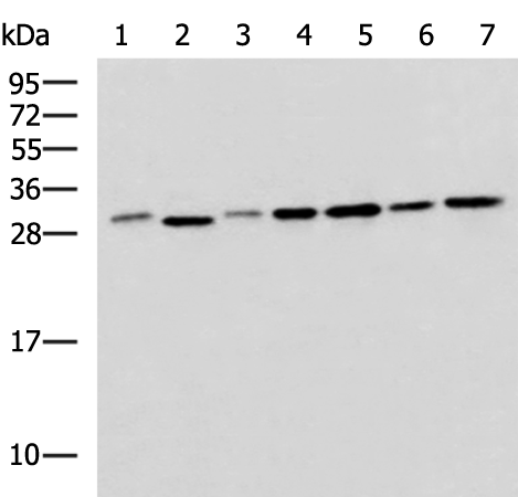 Anti-EXOSC4 Rabbit Polyclonal Antibody