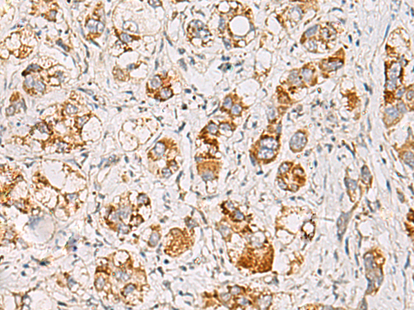 Anti-MMAB Rabbit Polyclonal Antibody