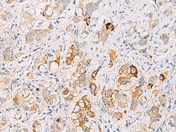 Anti-DHRS2 Rabbit Polyclonal Antibody