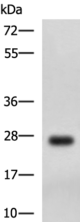 Anti-DHRS2 Rabbit Polyclonal Antibody