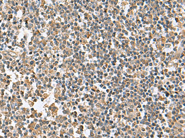 Anti-KRCC1 Rabbit Polyclonal Antibody