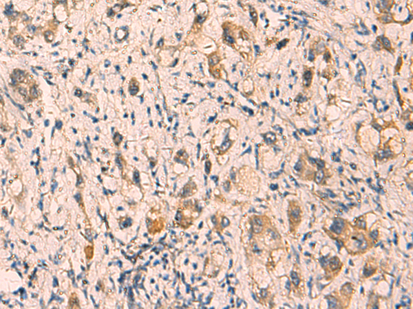 Anti-CRYM Rabbit Polyclonal Antibody