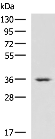 Anti-CRYM Rabbit Polyclonal Antibody