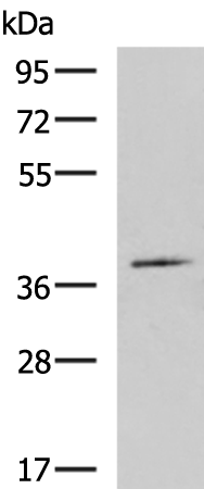 Anti-FBXO8 Rabbit Polyclonal Antibody