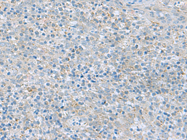 Anti-PYCR2 Rabbit Polyclonal Antibody