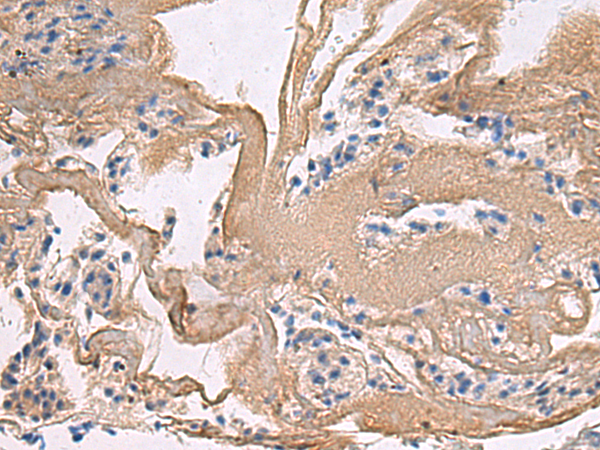 Anti-GALM Rabbit Polyclonal Antibody