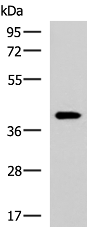 Anti-GALM Rabbit Polyclonal Antibody