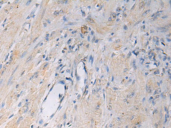 Anti-HSDL2 Rabbit Polyclonal Antibody