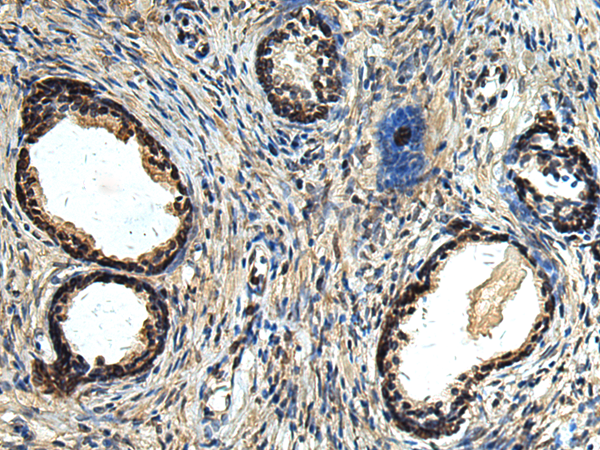 Anti-ERLIN1 Rabbit Polyclonal Antibody