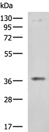 Anti-ERLIN1 Rabbit Polyclonal Antibody