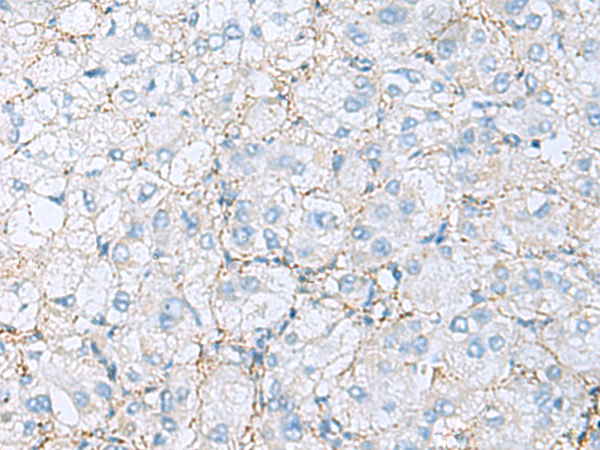 Anti-EMILIN1 Rabbit Polyclonal Antibody