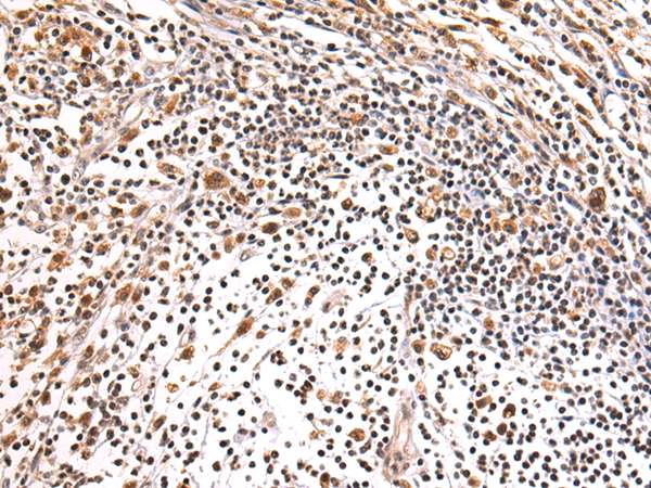 Anti-HEATR1 Rabbit Polyclonal Antibody