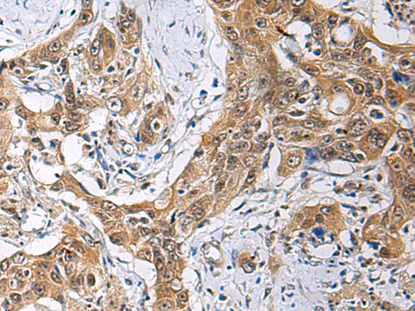 Anti-THOC3 Rabbit Polyclonal Antibody