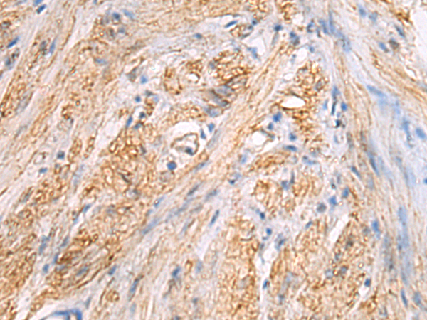 Anti-Tropomodulin 3 Rabbit Polyclonal Antibody
