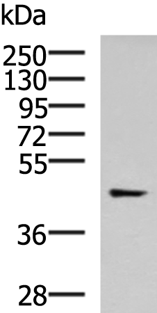 Anti-Tropomodulin 3 Rabbit Polyclonal Antibody