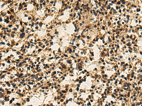 Anti-PRELP Rabbit Polyclonal Antibody