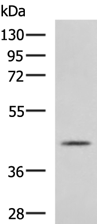 Anti-PRELP Rabbit Polyclonal Antibody