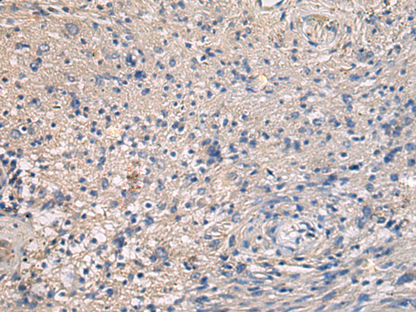 Anti-MAPKAP Kinase 3 Rabbit Polyclonal Antibody