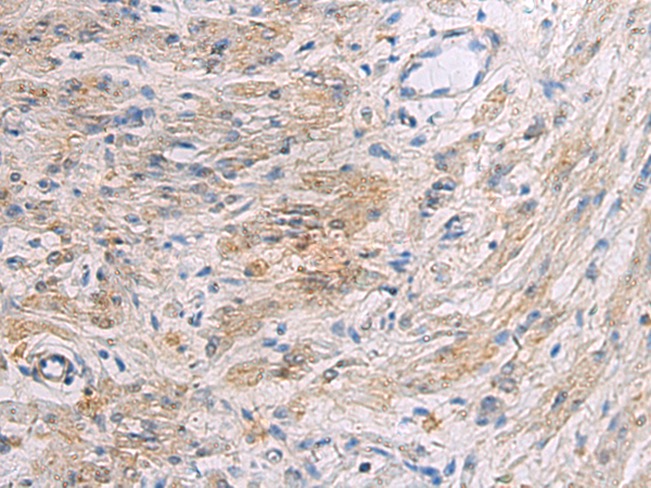 Anti-SLC30A3 Rabbit Polyclonal Antibody
