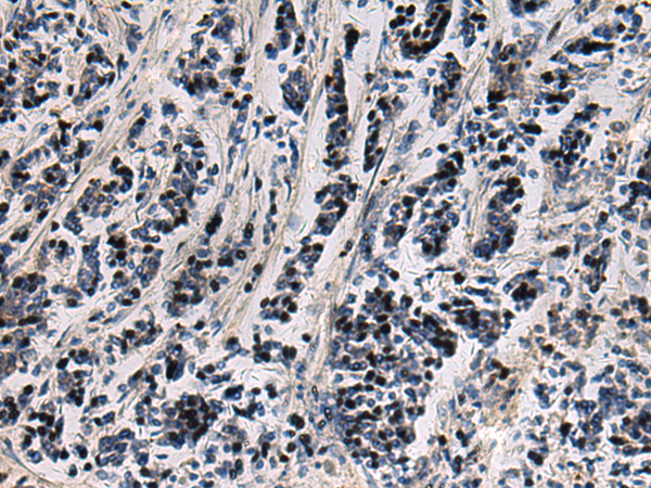 Anti-SNIP1 Rabbit Polyclonal Antibody