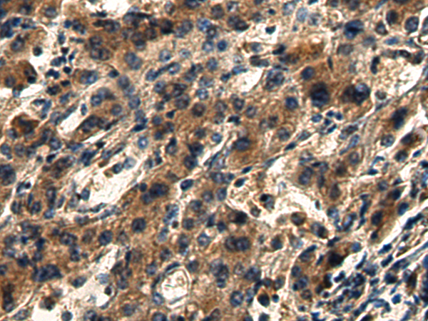 Anti-MYLIP Rabbit Polyclonal Antibody