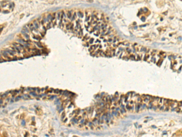 Anti-FKBP3 Rabbit Polyclonal Antibody