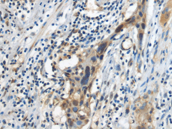 Anti-CMC1 Rabbit Polyclonal Antibody