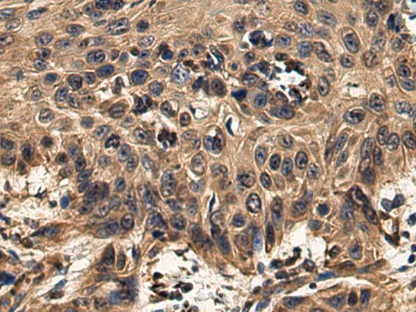 Anti-GBA3 Rabbit Polyclonal Antibody