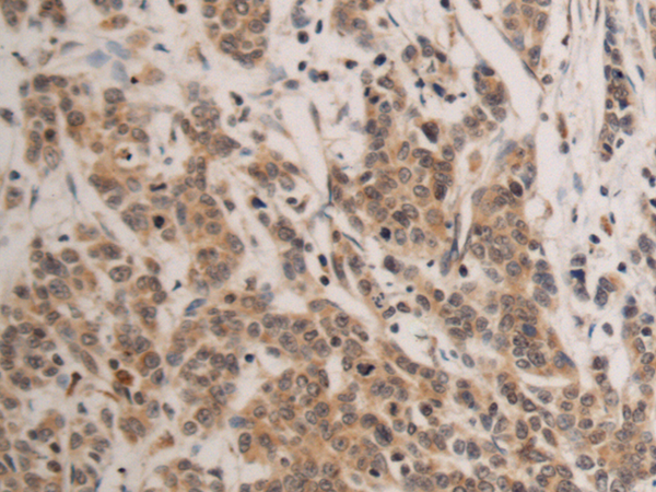 Anti-ENDOGL1 Rabbit Polyclonal Antibody