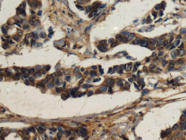 Anti-TTLL10 Rabbit Polyclonal Antibody