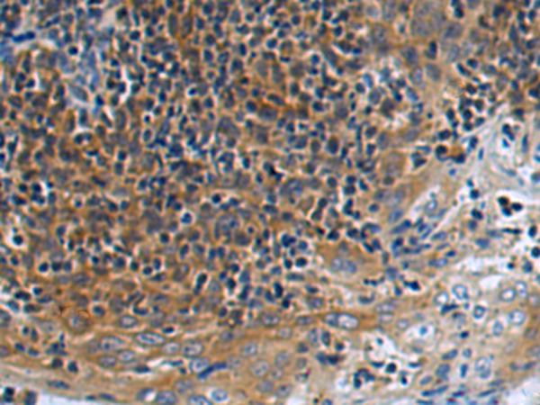 Anti-ATXN10 Rabbit Polyclonal Antibody