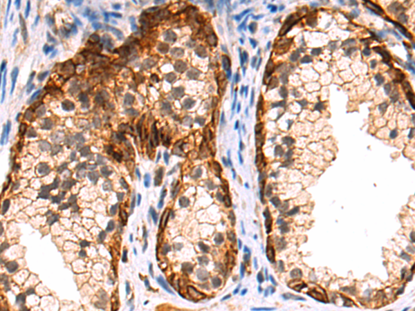 Anti-Myocilin Rabbit Polyclonal Antibody