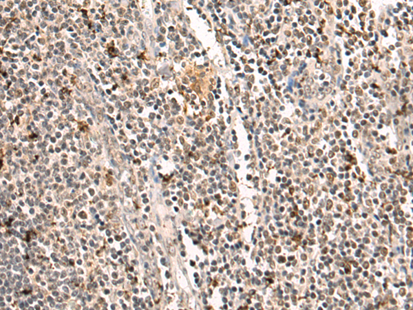 Anti-TOE1 Rabbit Polyclonal Antibody