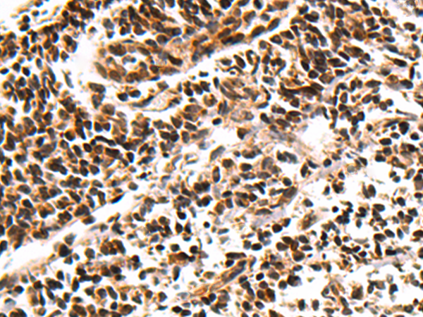 Anti-RPUSD2 Rabbit Polyclonal Antibody