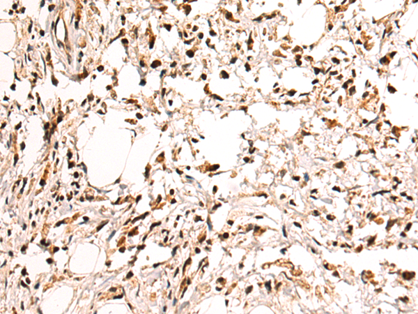 Anti-NOP58 Rabbit Polyclonal Antibody