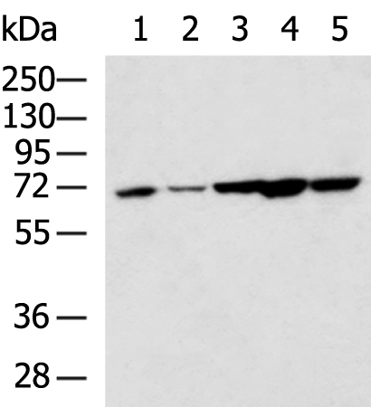Anti-NOP58 Rabbit Polyclonal Antibody