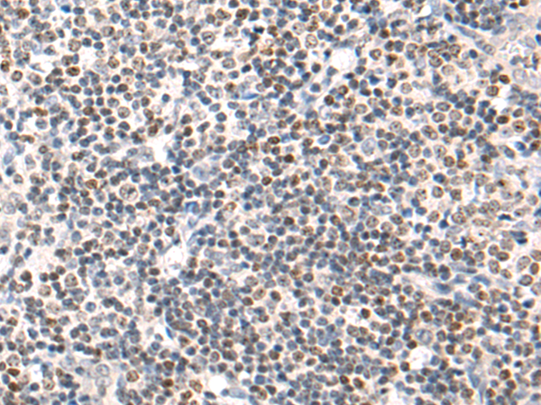 Anti-SP110 Rabbit Polyclonal Antibody
