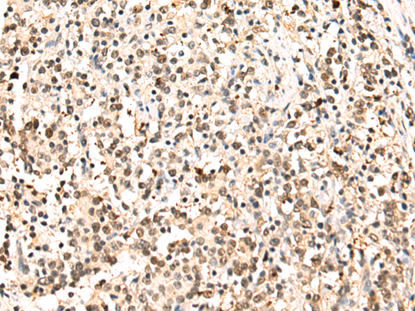 Anti-TUG Rabbit Polyclonal Antibody