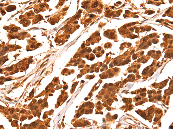 Anti-LRWD1 Rabbit Polyclonal Antibody