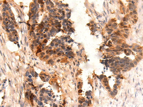 Anti-S100A2 Rabbit Polyclonal Antibody