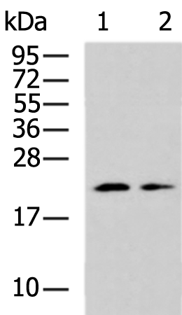 Anti-RPS10 Rabbit Polyclonal Antibody