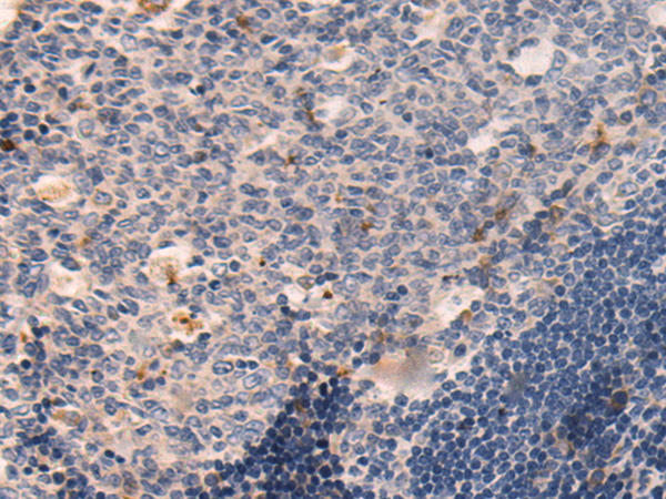 Anti-RPS7 Rabbit Polyclonal Antibody