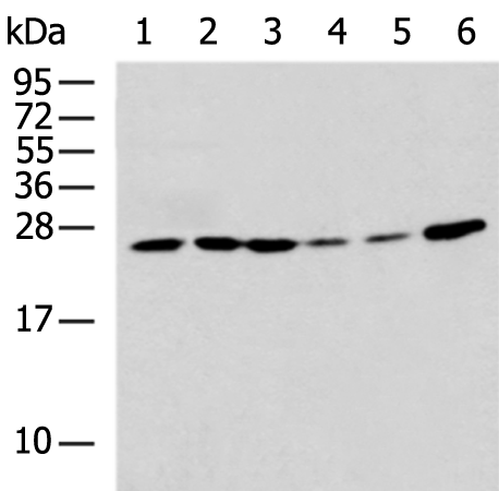 Anti-RPS7 Rabbit Polyclonal Antibody