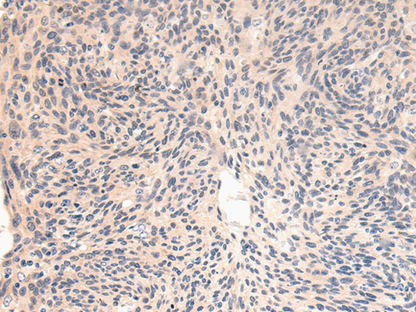 Anti-TRPT1 Rabbit Polyclonal Antibody