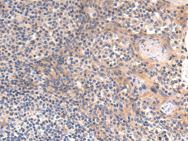 Anti-PCCB Rabbit Polyclonal Antibody